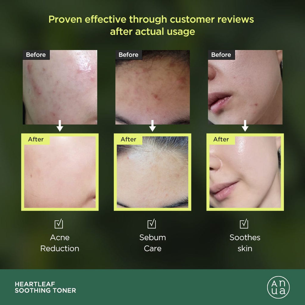 ANUA Heartleaf 77% Soothing Toner 韩国ANUA 鱼腥草77%精华爽肤水 250ml