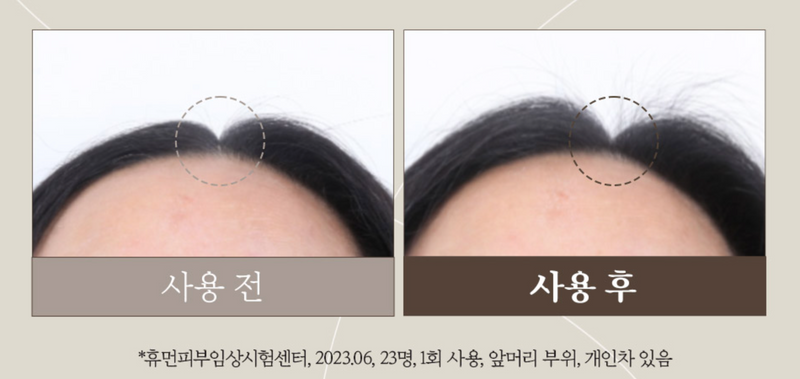 MOSTORY Mogeundan Anti Hair Loss Root Strengthen Shampoo Ball 韩国MOSTORY 强健发根防脱洗发皂 100g